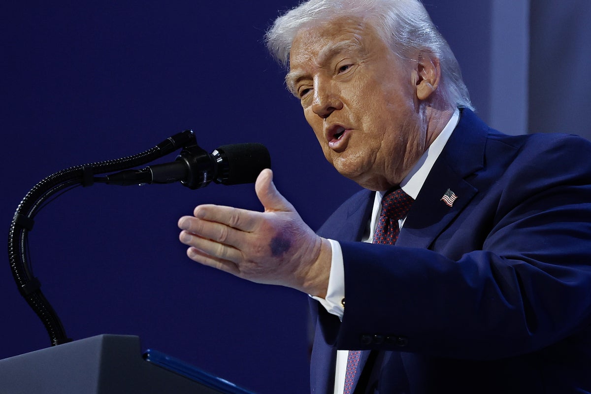 Dick Cheney'nin doktoru, Amerikalıların Trump'ı etkileyen gizemli rahatsızlıklarla ilgili "cevapları hak ettiğini" söylüyor