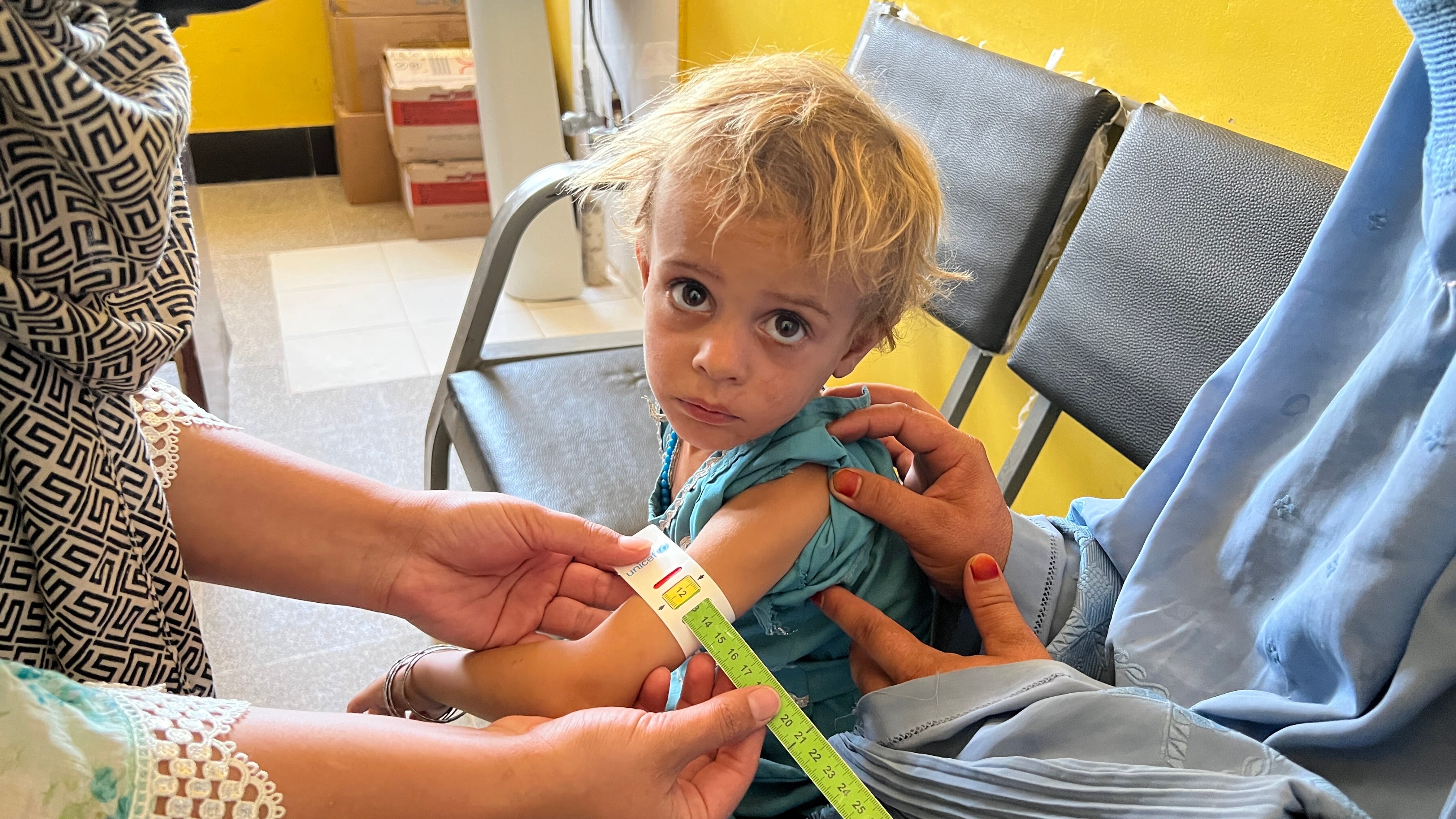 Sediqa’s daughter, who suffers from malnutrition, at a WFP clinic
