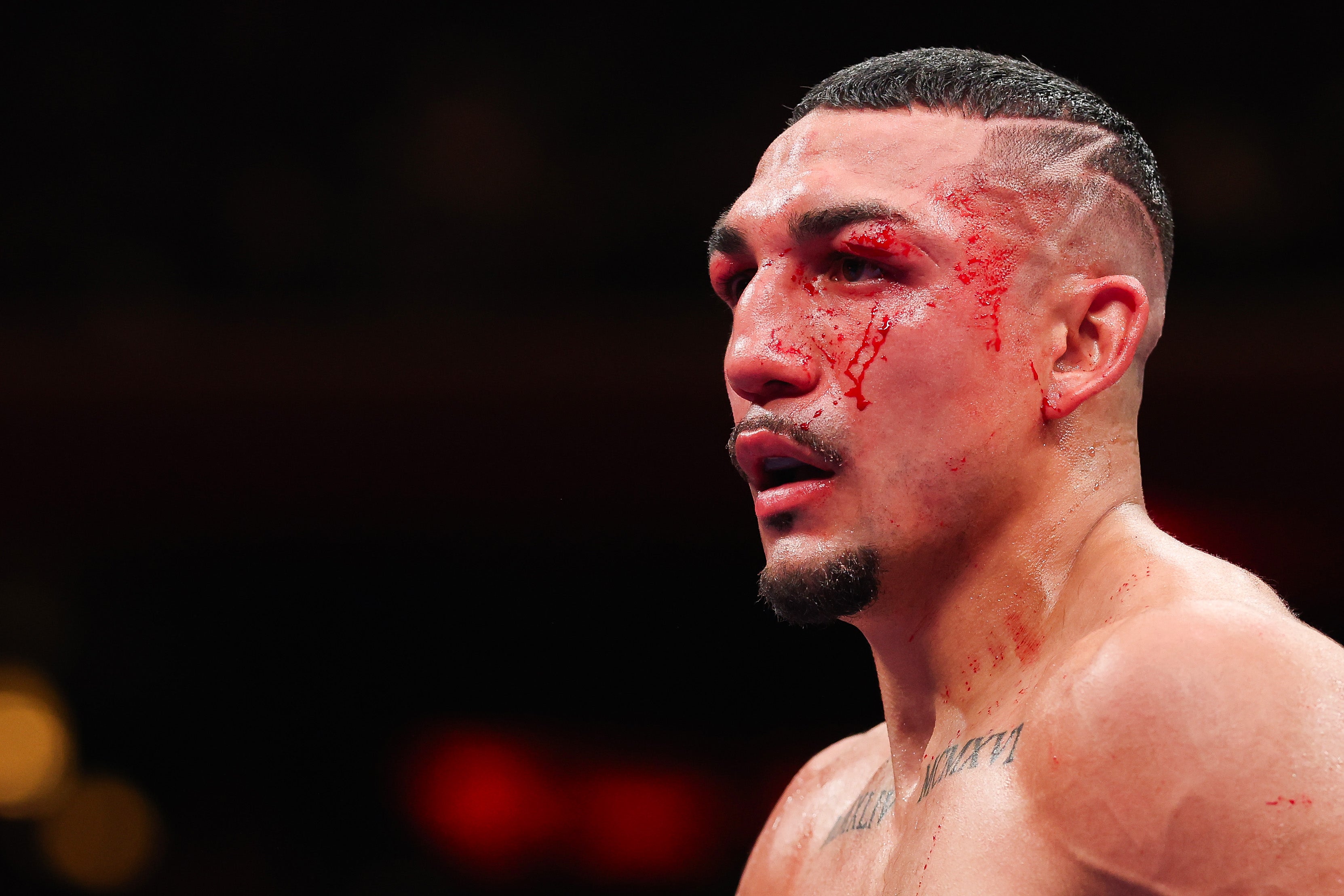 Lopez is aiming to bounce back from a loss to a magnificent Shakur Stevenson