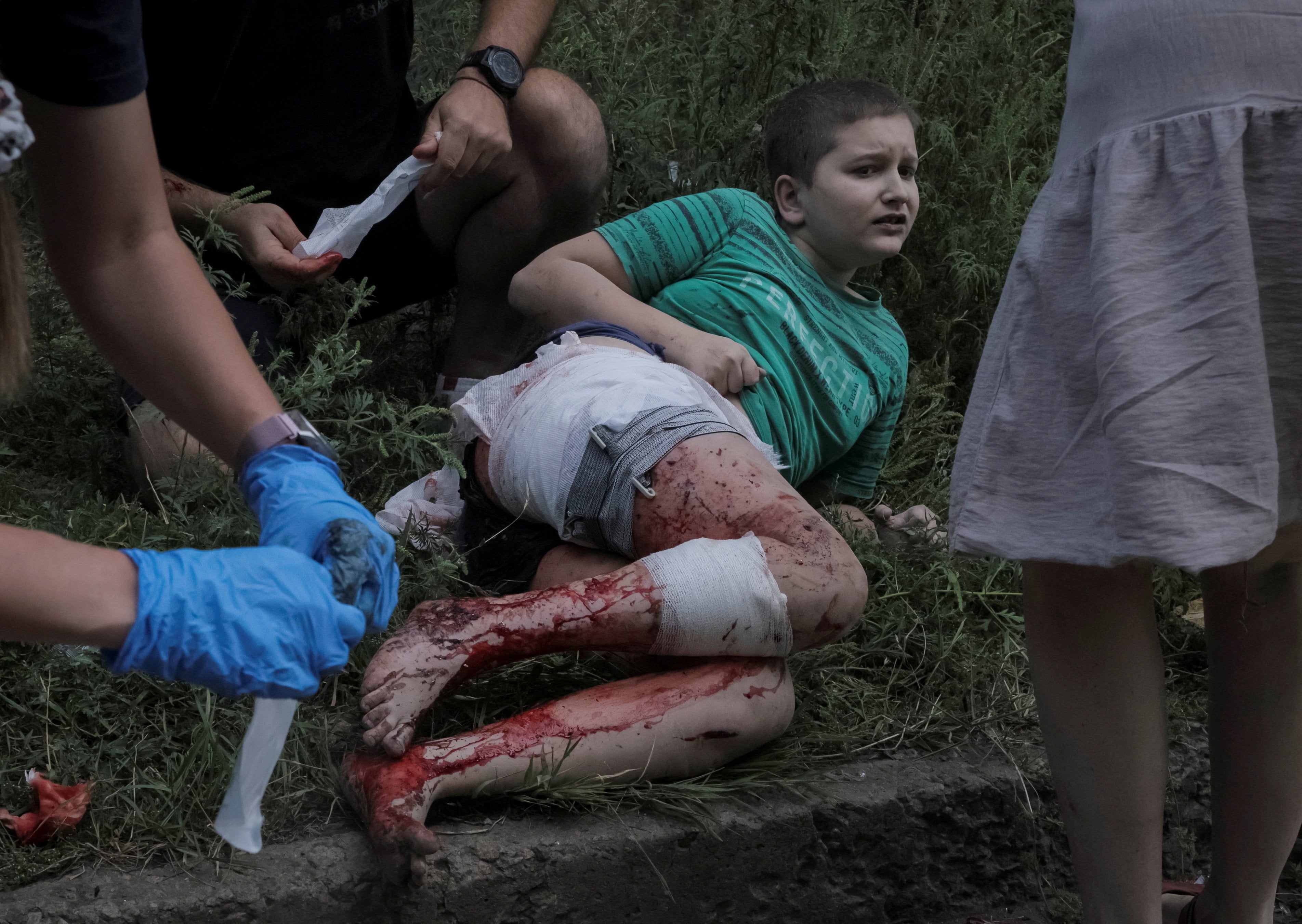 Volunteers treat a wounded boy at the site of an apartment building hit by a Russian strike in Donetsk