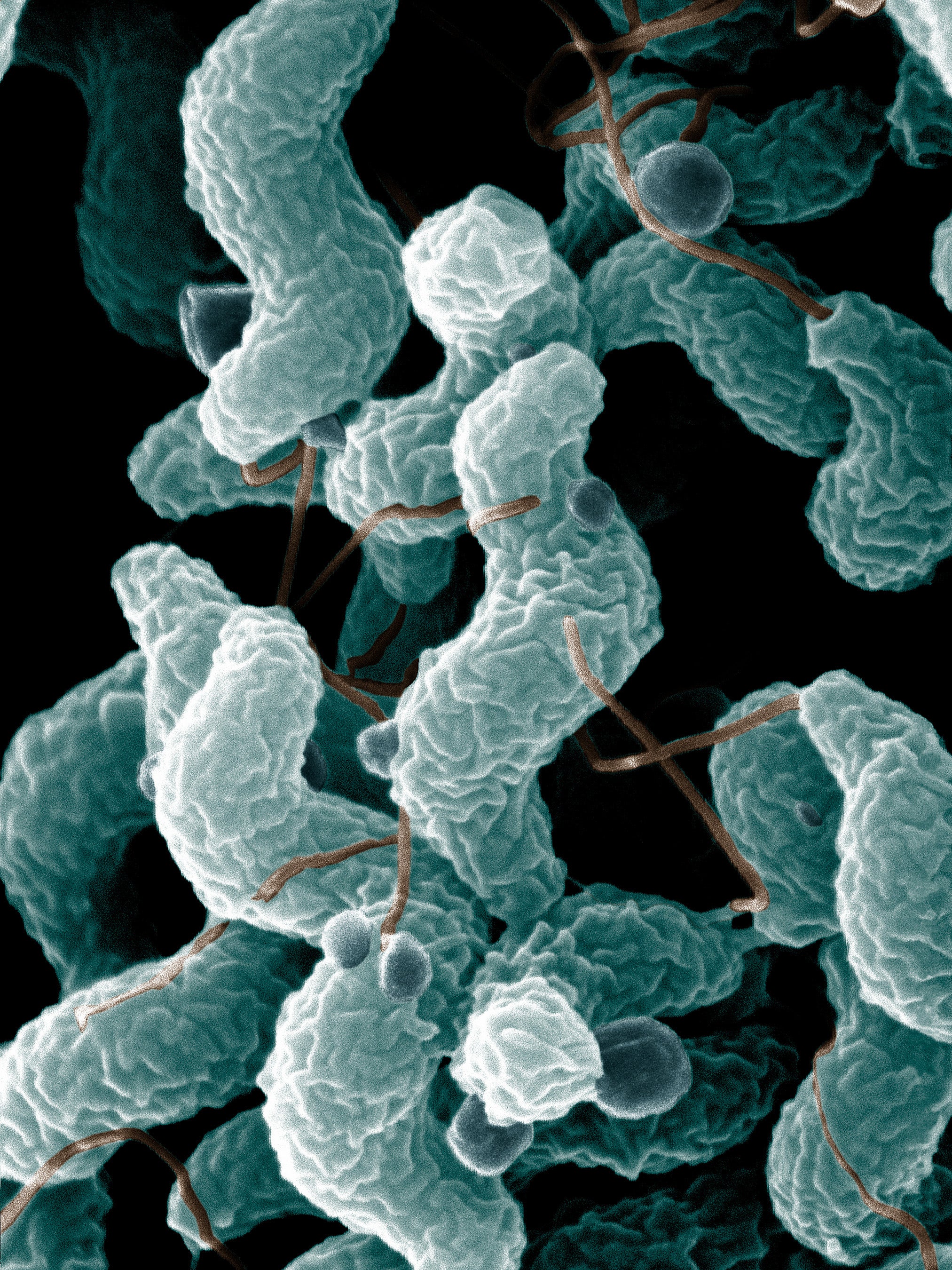 Campylobacter can be extremely risky to people over 65, according to the Centers for Disease Control and Prevention. Roxie Ellis Douglas, 68, is suing Wendy's over claims she contracted campylobacteriosis from a double cheeseburger she ordered from the chain