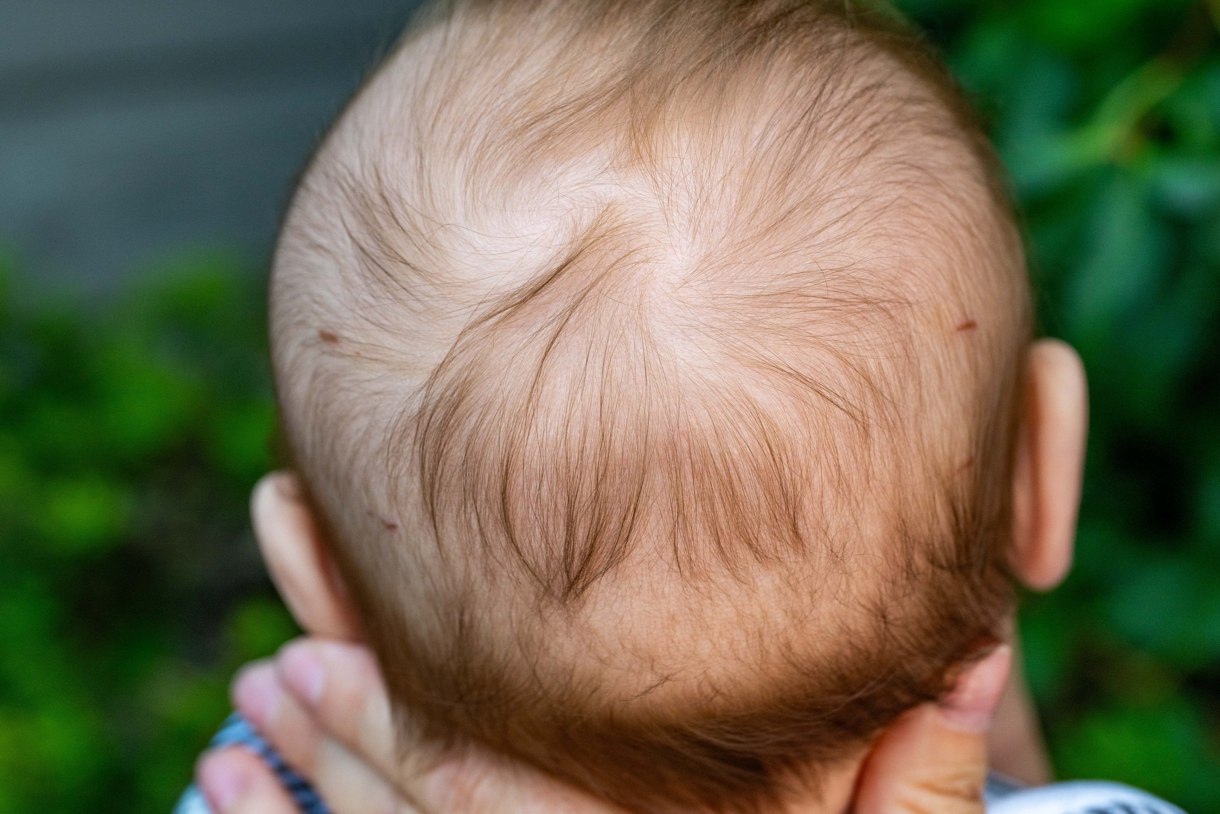 Ms Clarkson screamed before realising the full horror as she saw four, bloody puncture wounds on her baby's head