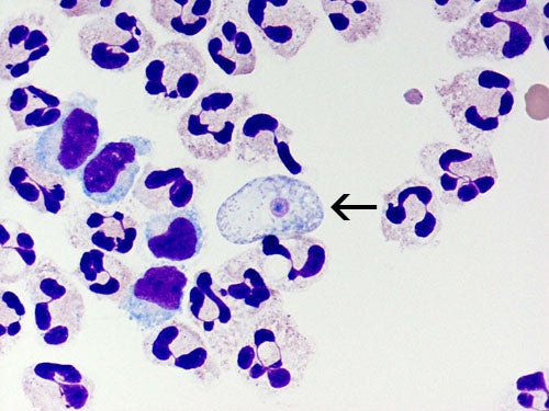 Naegleria fowleri (pictured) can cause a deadly infection known as primary amebic meningoencephalitis