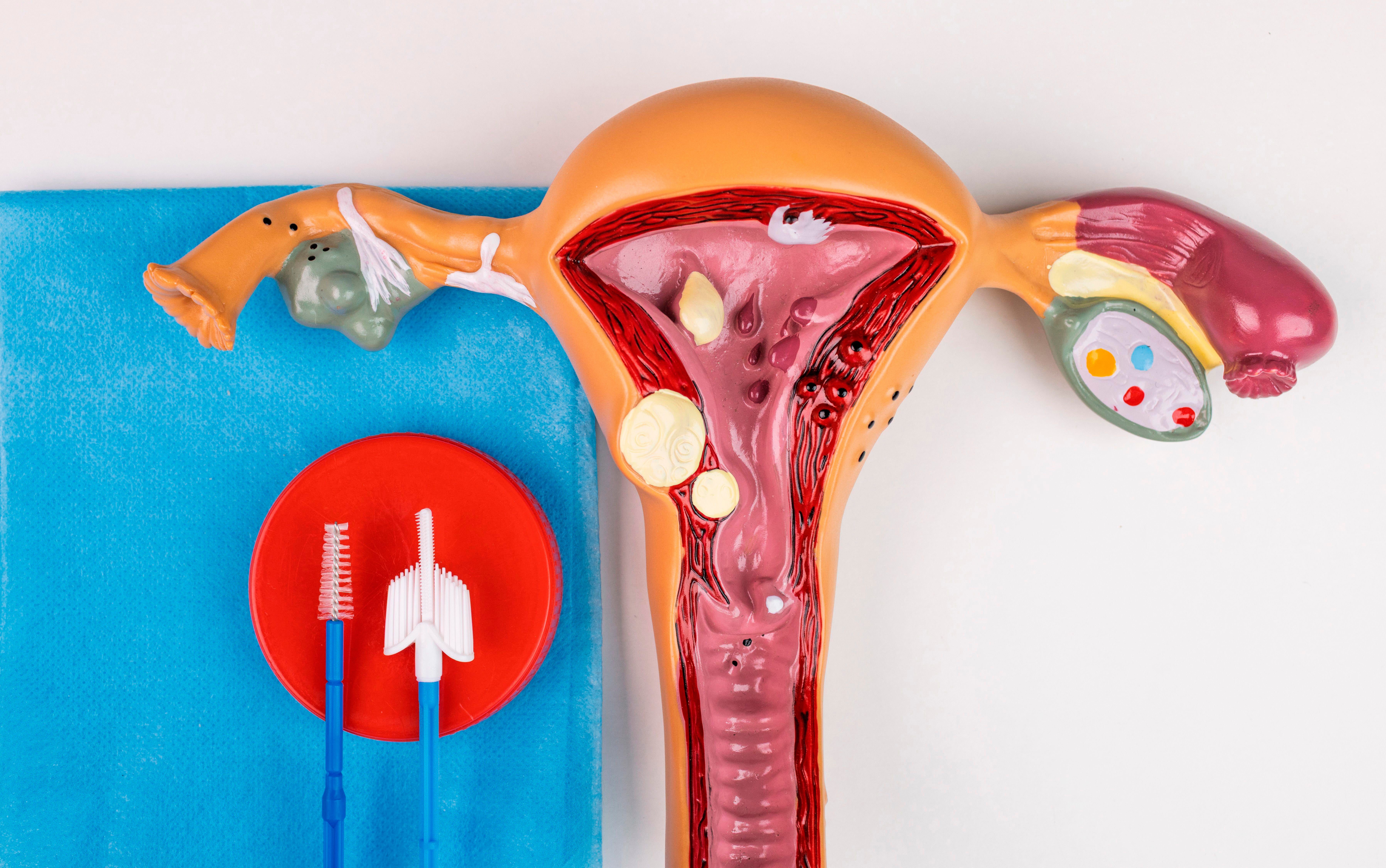 Recent statistics show that 51 per cent of ethnic minority women are not accessing cervical screening to NHS-recommended levels