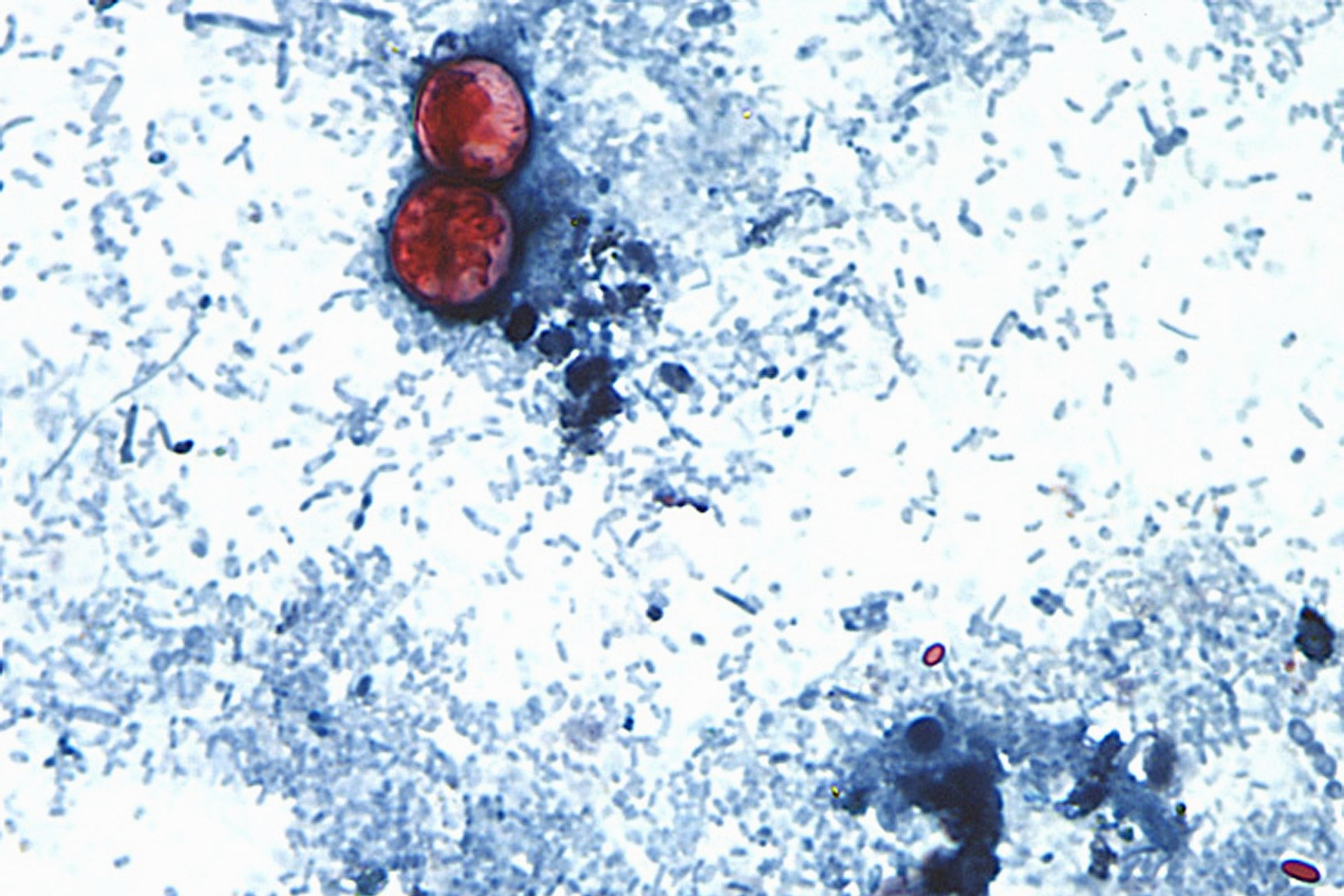 independent.co.uk - Matthew Perrone - Cyclospora outbreak followed years of declining FDA foreign inspections