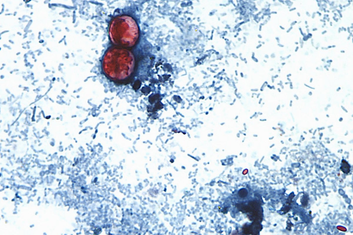 US health officials link Cyclospora outbreak to iceberg lettuce in additional states
