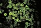 North Carolina teen critically ill after being infected ​with rare brain-eating amoeba