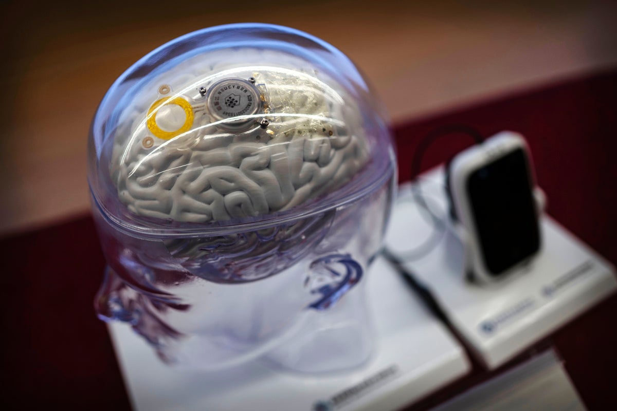Ilustración o representación de un dispositivo de interfaz cerebro-computadora.