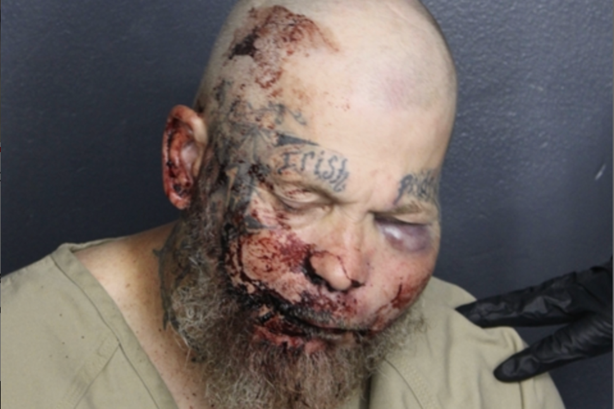 Horrific mugshot shows injuries of Florida man who is accused of attacking cop in the hospital Horrific mugshot shows injuries of Florida man who is accused of attacking cop in the hospital