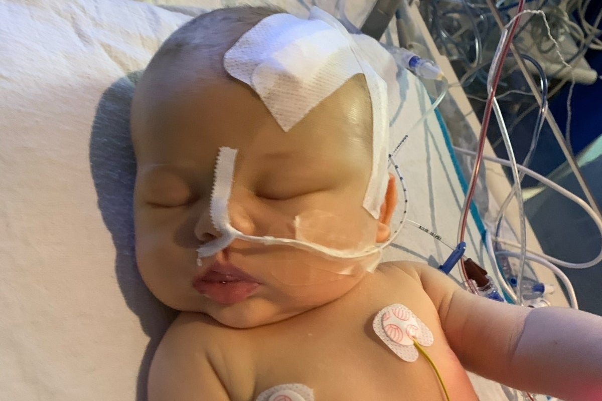 Newborn diagnosed with brain tumour after doctors spot tiny detail on fingernail Newborn diagnosed with brain tumour after doctors spot tiny detail on fingernail