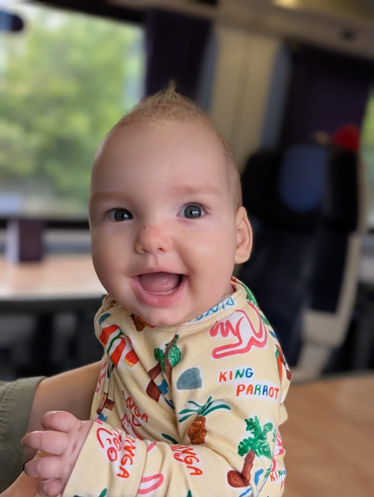 Derbyshire toddler undergoes world-first surgery for rare skull condition