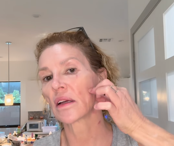 Brandi Glanville shares emotional update on facial parasite: &lsquo;I want my life back&rsquo;