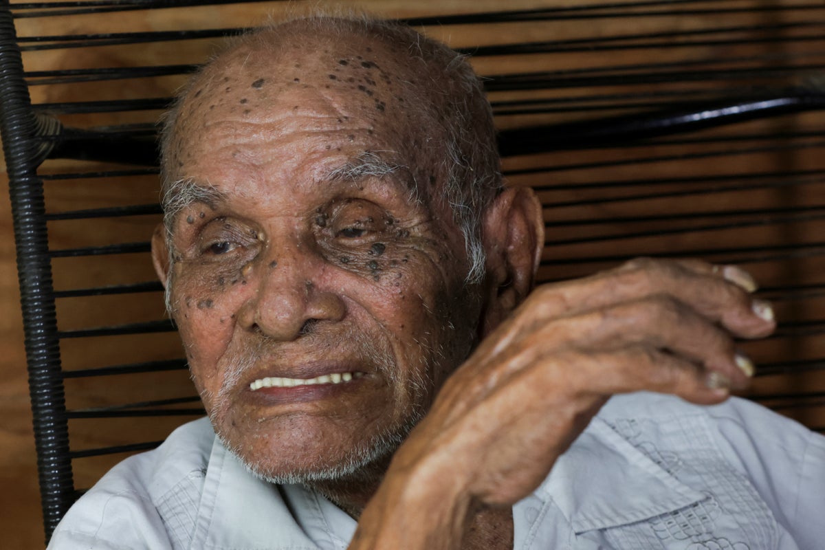 The Man Who Outlived the Century