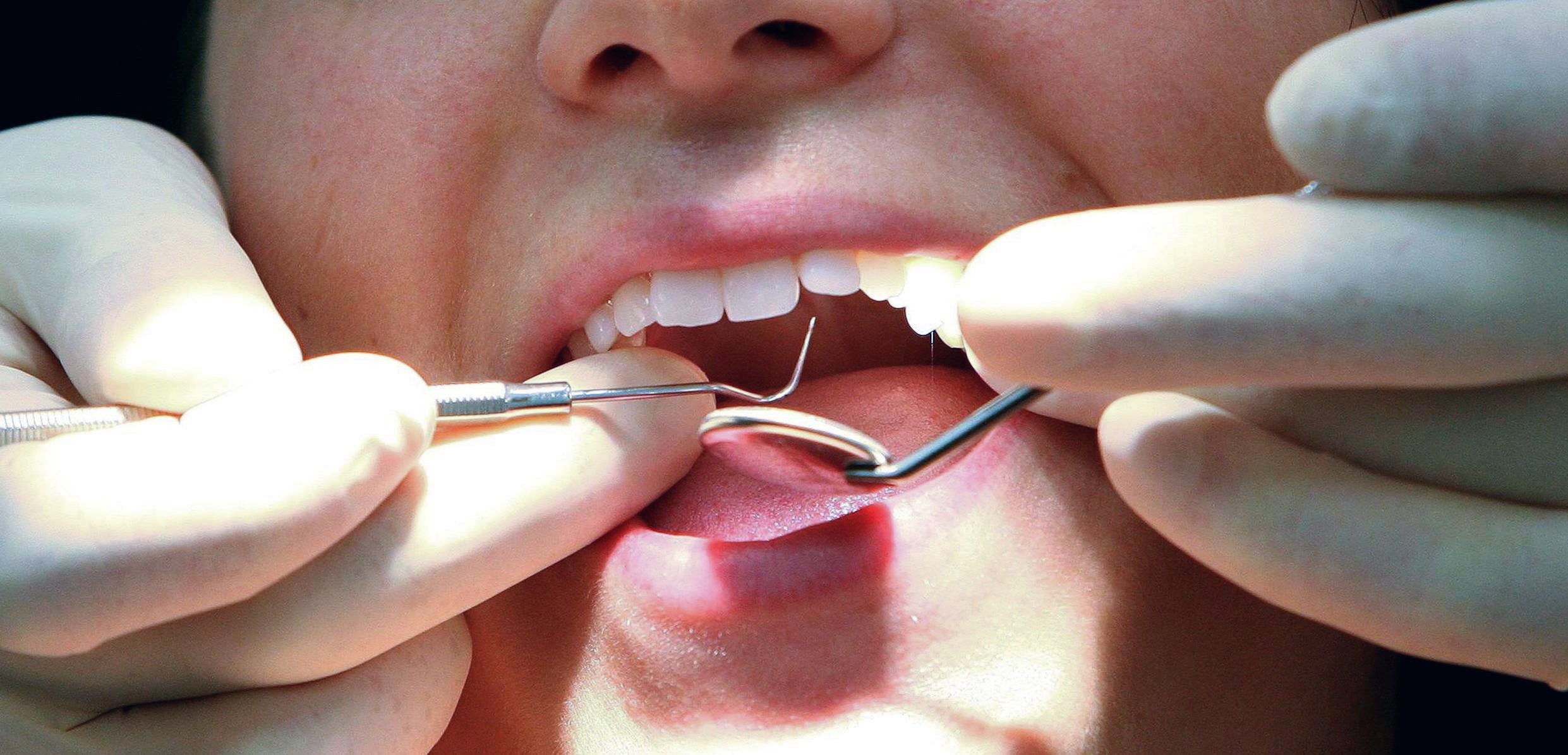 Dentists and GPs offered training to spot early MND signs in UK first