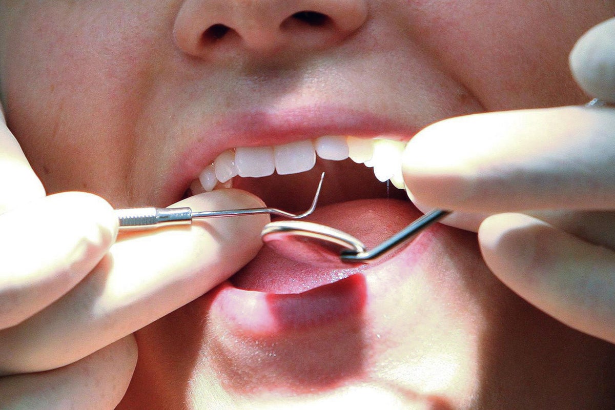 Dentists and GPs offered training to spot early MND signs in UK first