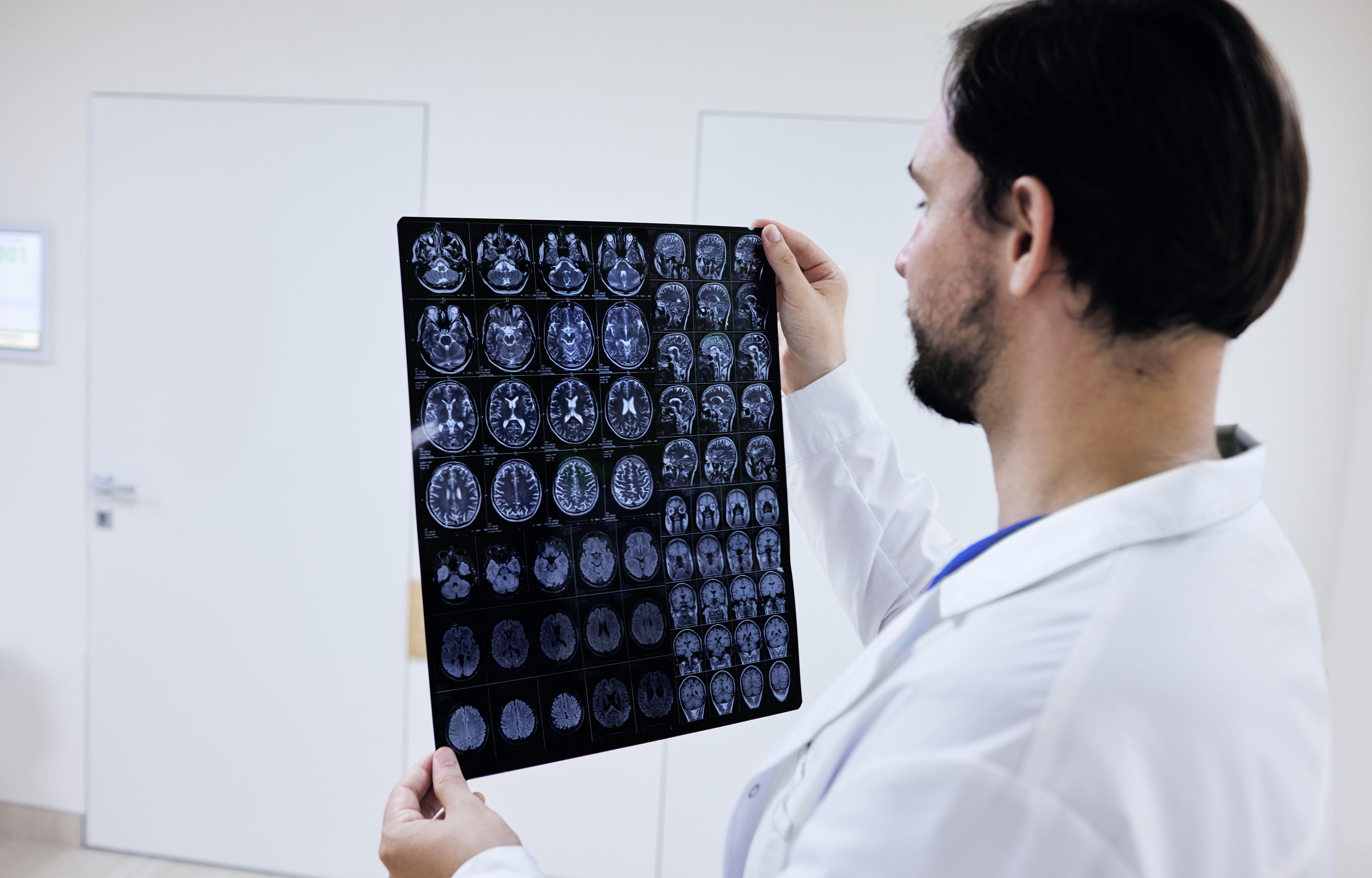 2K1YHEA General practitioner looking at MRI of human brain and examining anatomy and pathology of patient’s brain while standing in corridor hospital