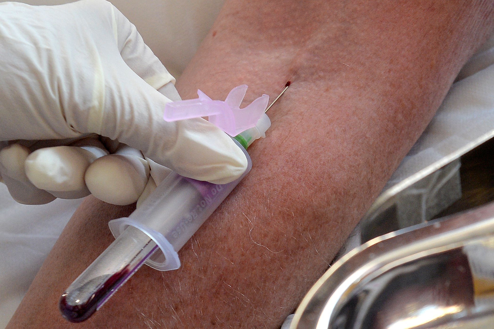 Standard diagnosis currently relies on a blood test (Anthony Devlin/PA)