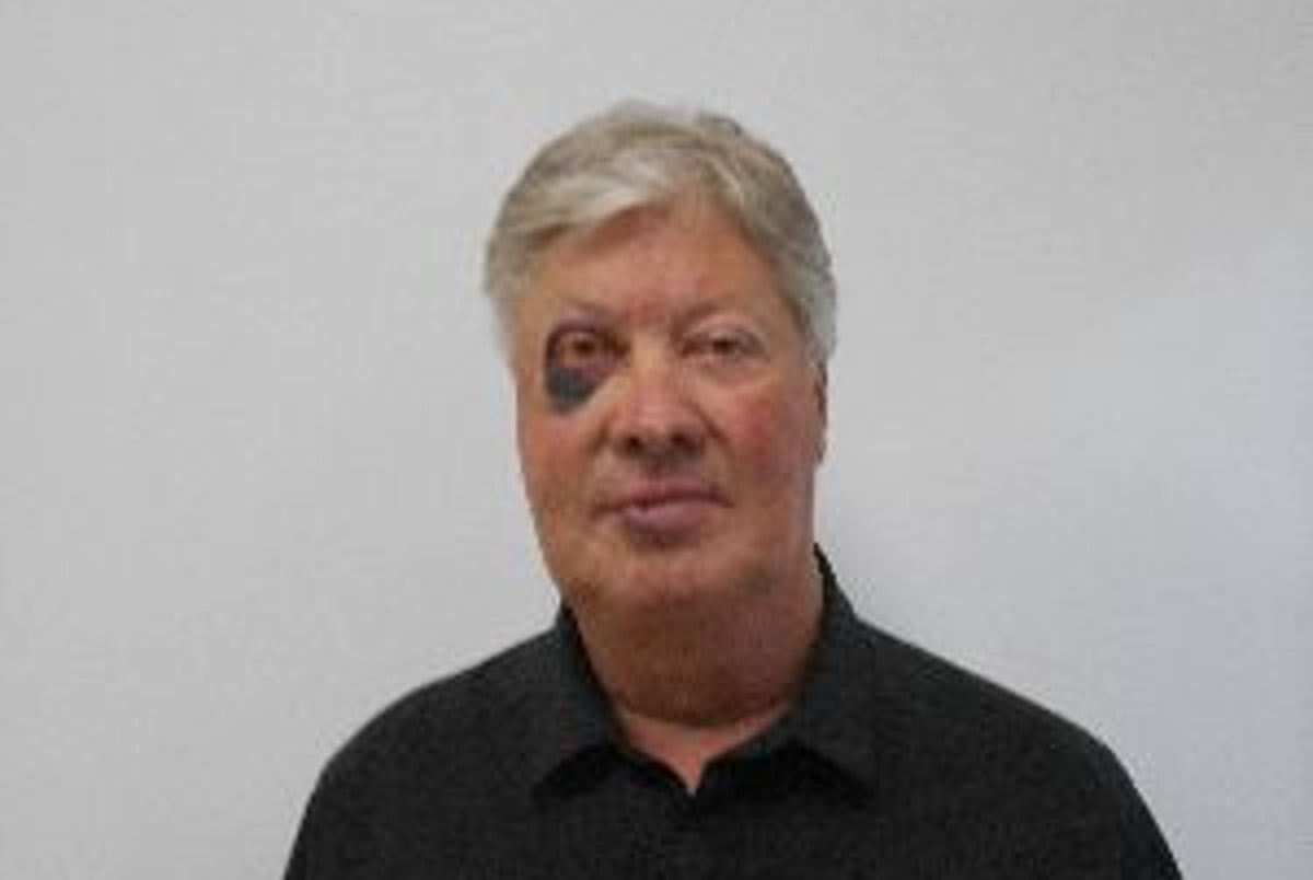 Disgraced former megachurch pastor Robert Morris seen with black eye in new sex offender registry photo