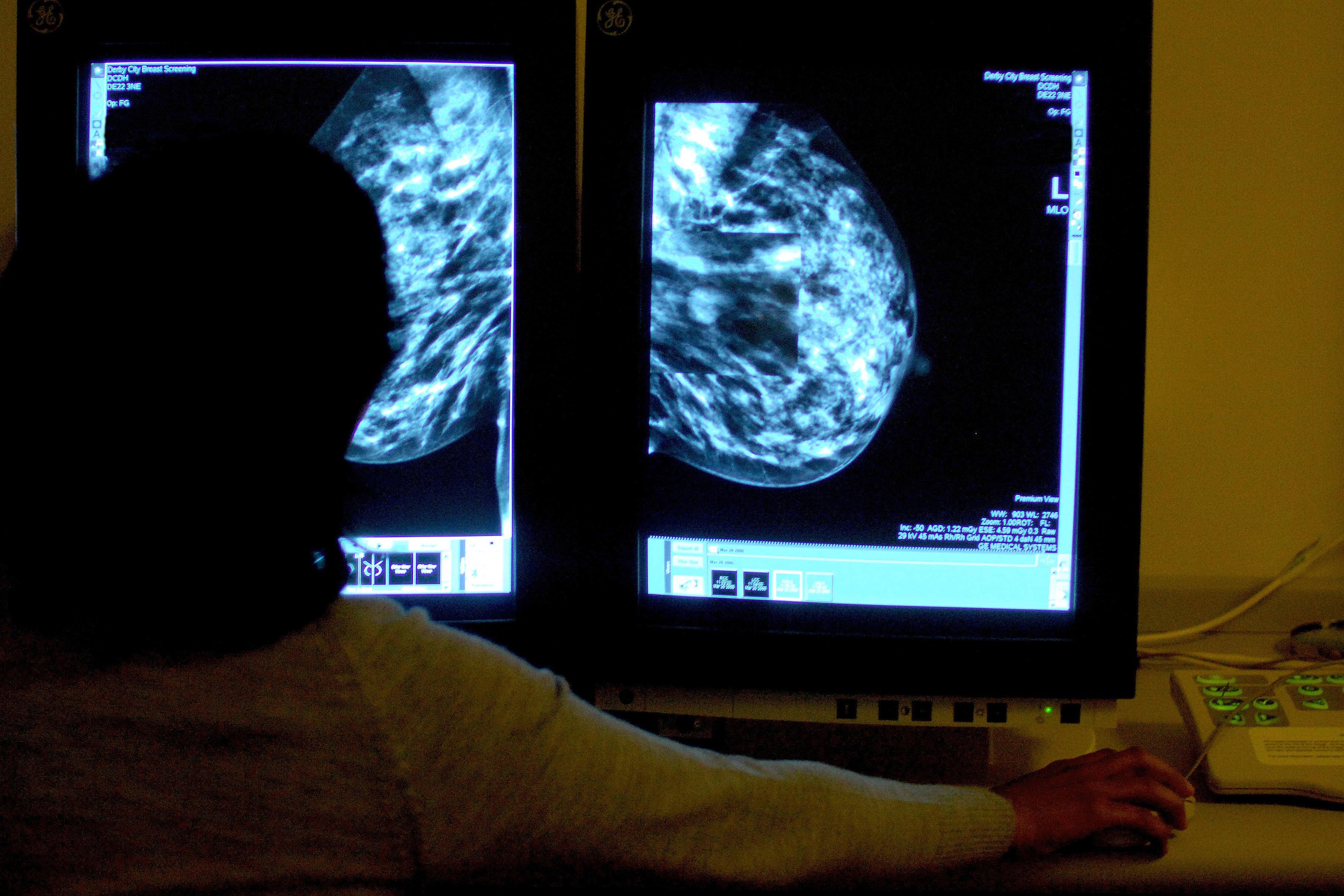 File image - One patient said, ‘no other mammographer had ever carried out the procedure in the same manner’