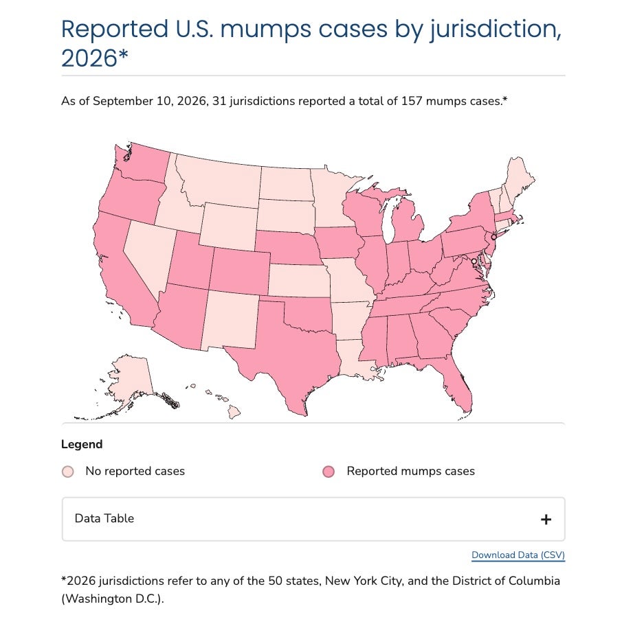 This U.S. Centers for Disease Control and Prevention map shows where mumps cases have been reported nationwide this year, highlighting those states and jurisdictions in dark pink