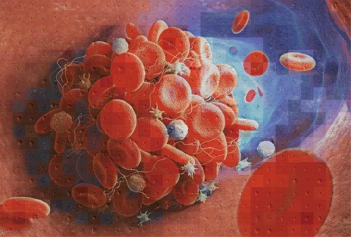 Mosaic of a blood clot