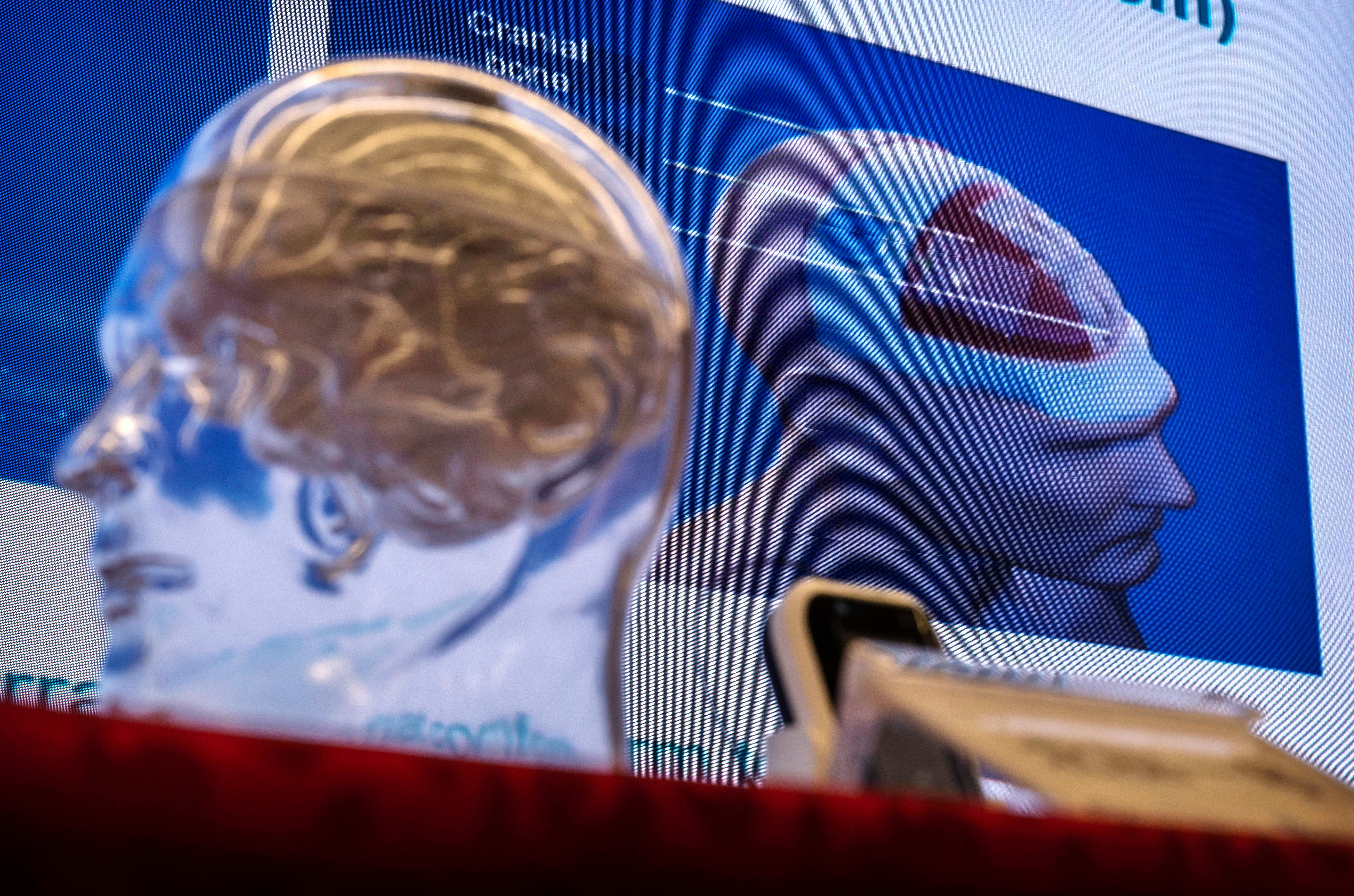 Scientists map gene activity in brain’s prefrontal cortex shedding light on Alzheimer’s, schizophrenia