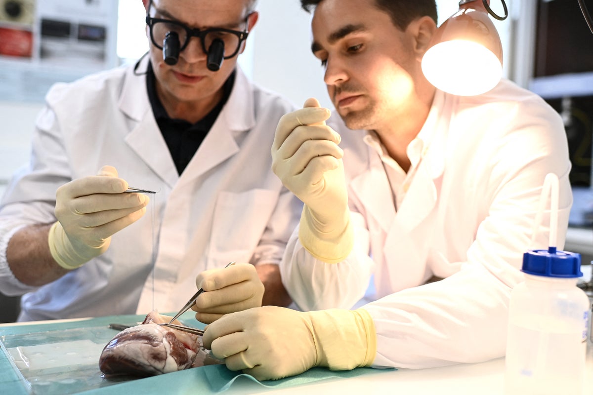 Organ transplants might hold answers to ‘fountain of youth’, scientists say
