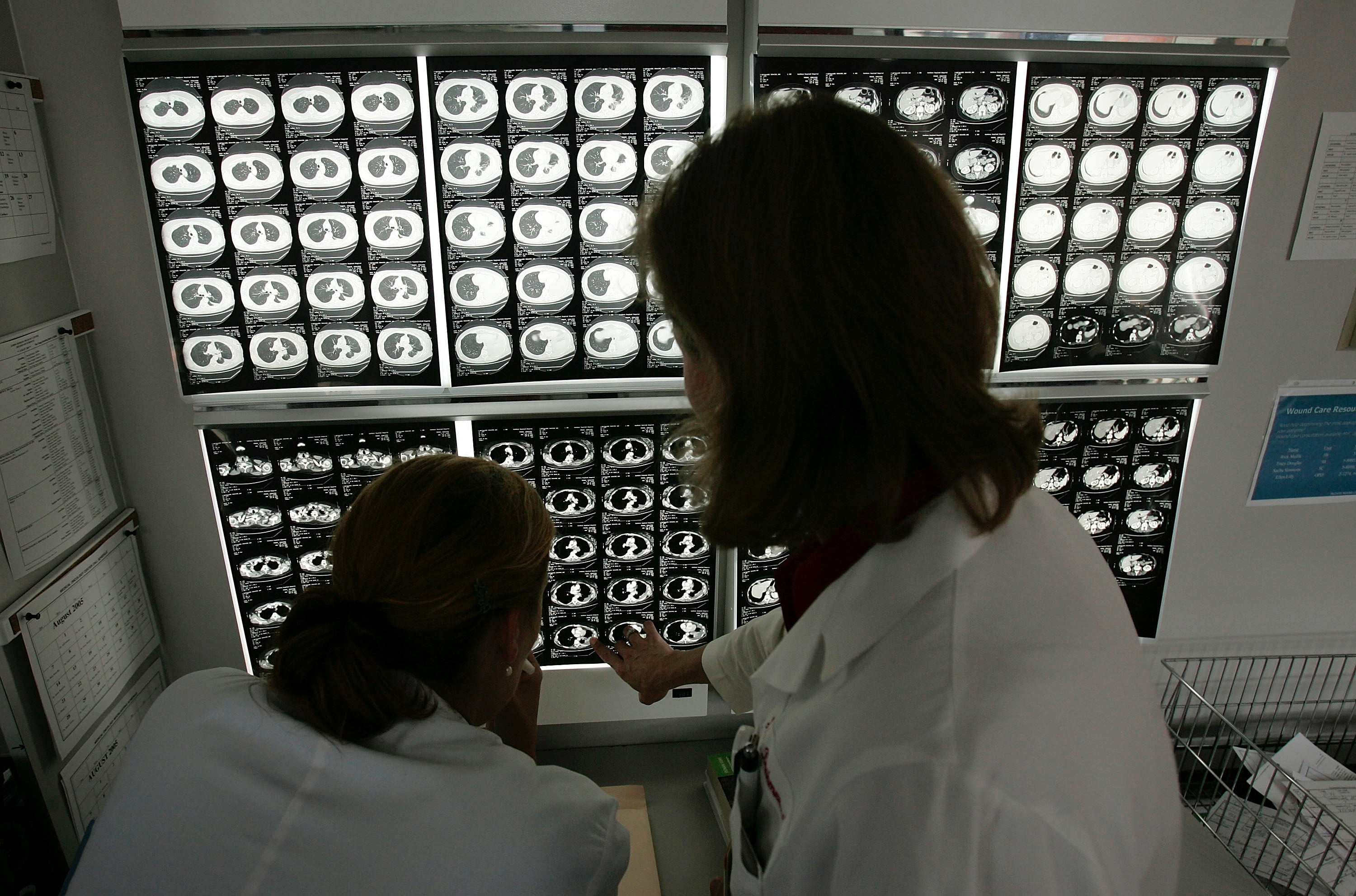 One in eight global cancer cases are linked to infectious agents, a new review of 2024 data shows
