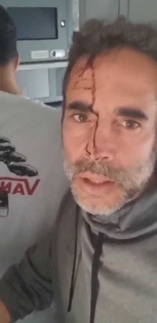 “We’re here during the hijacking of an airplane,” said one passenger with blood running down his face, in a video posted to social media. “At this point we’ve subdued the terrorists, we’re approaching landing. Whoever is hearing me, we need help.”