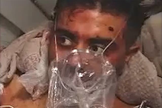 The other pilot was also seen with injuries and using a gas mask