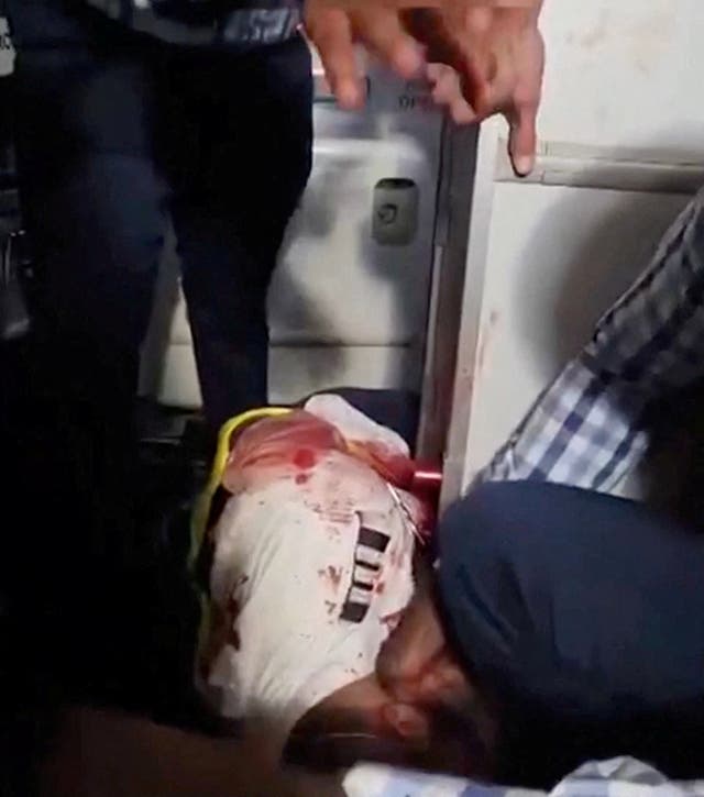 Passengers gather around an injured man aboard a Tel-Aviv-bound flydubai plane which was forced to land in Saudi Arabia after the pilots reportedly fought in the cockpit
