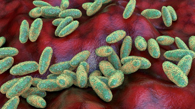 Plague bacteria (Yersinia pestis).