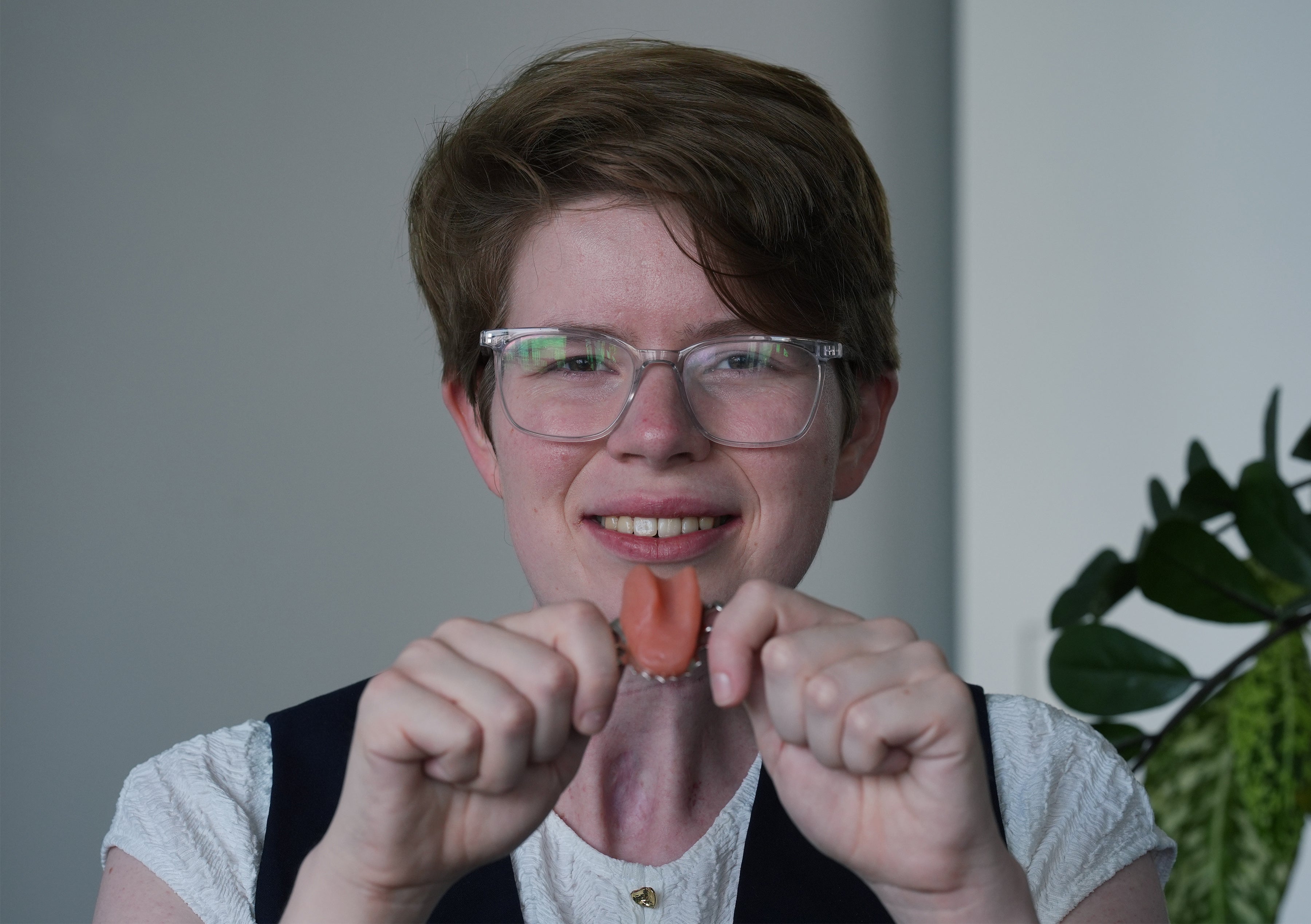 Cancer survivor who was left with speech problems given artificial tongue in UK first