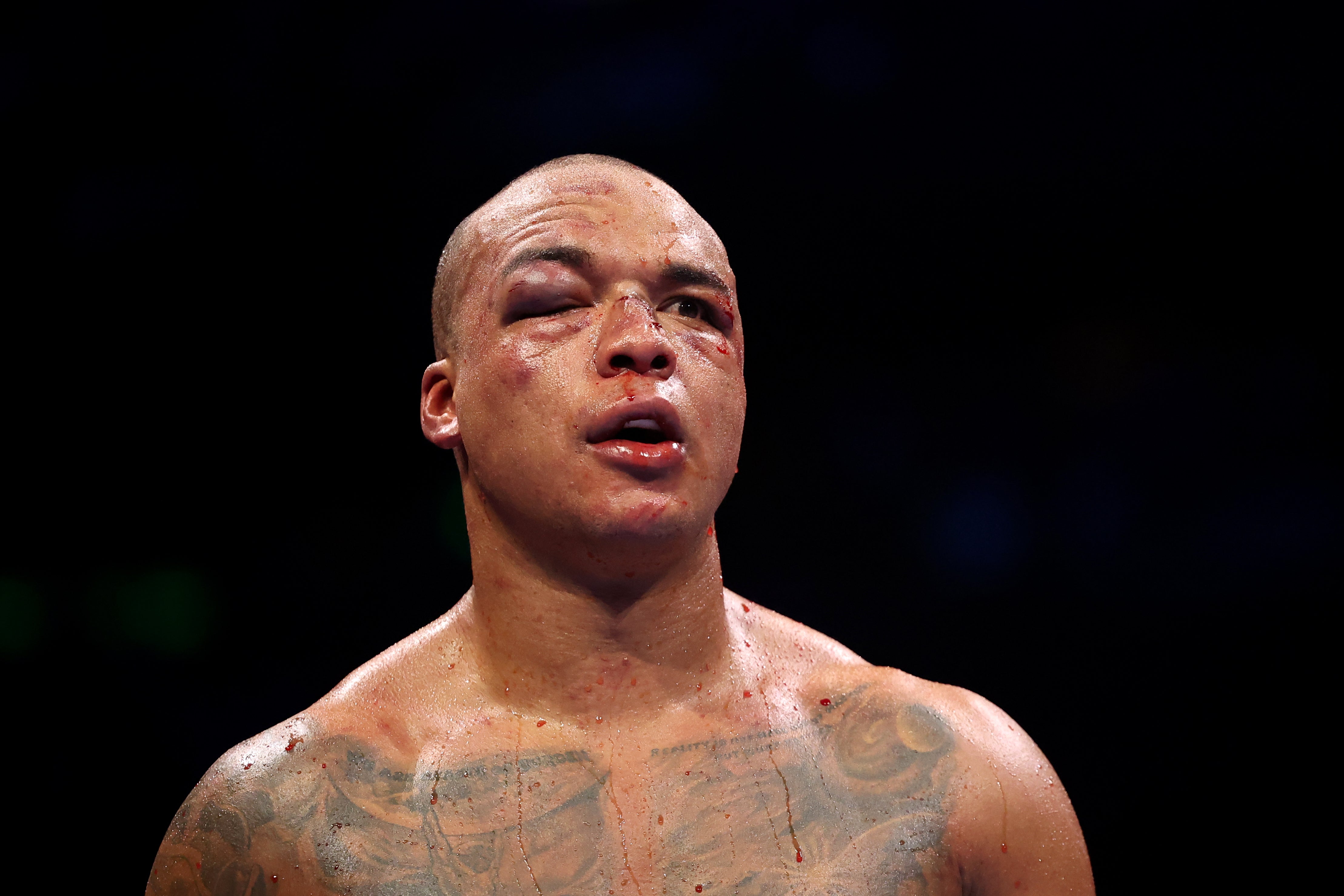 A battered and bruised Fabio Wardley immediately asked his promoter Frank Warren to set up the Daniel Dubois rematch