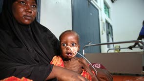 Somalia Malnutrition