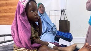 Somalia Malnutrition
