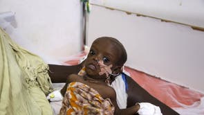 Somalia Malnutrition