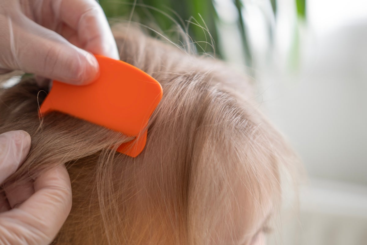 Pediatricians advise effective head lice treatment and caution against stigma and unproven remedies