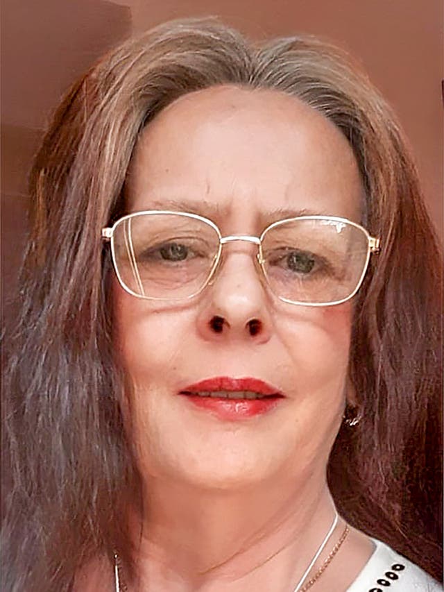 Carmen Price died after suffering bleeding around her eyes