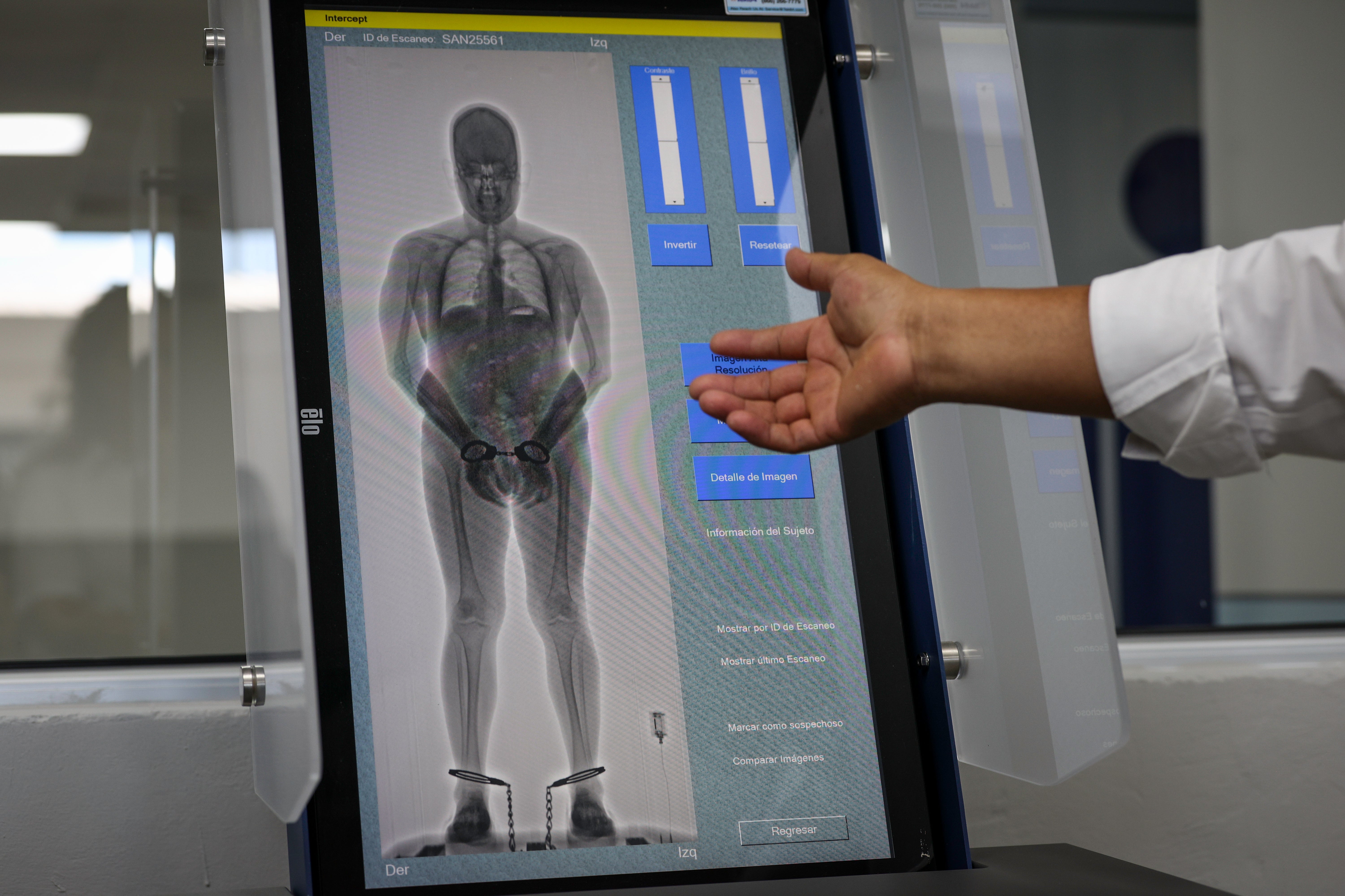 Brown fat was previously believed to vanish after infancy