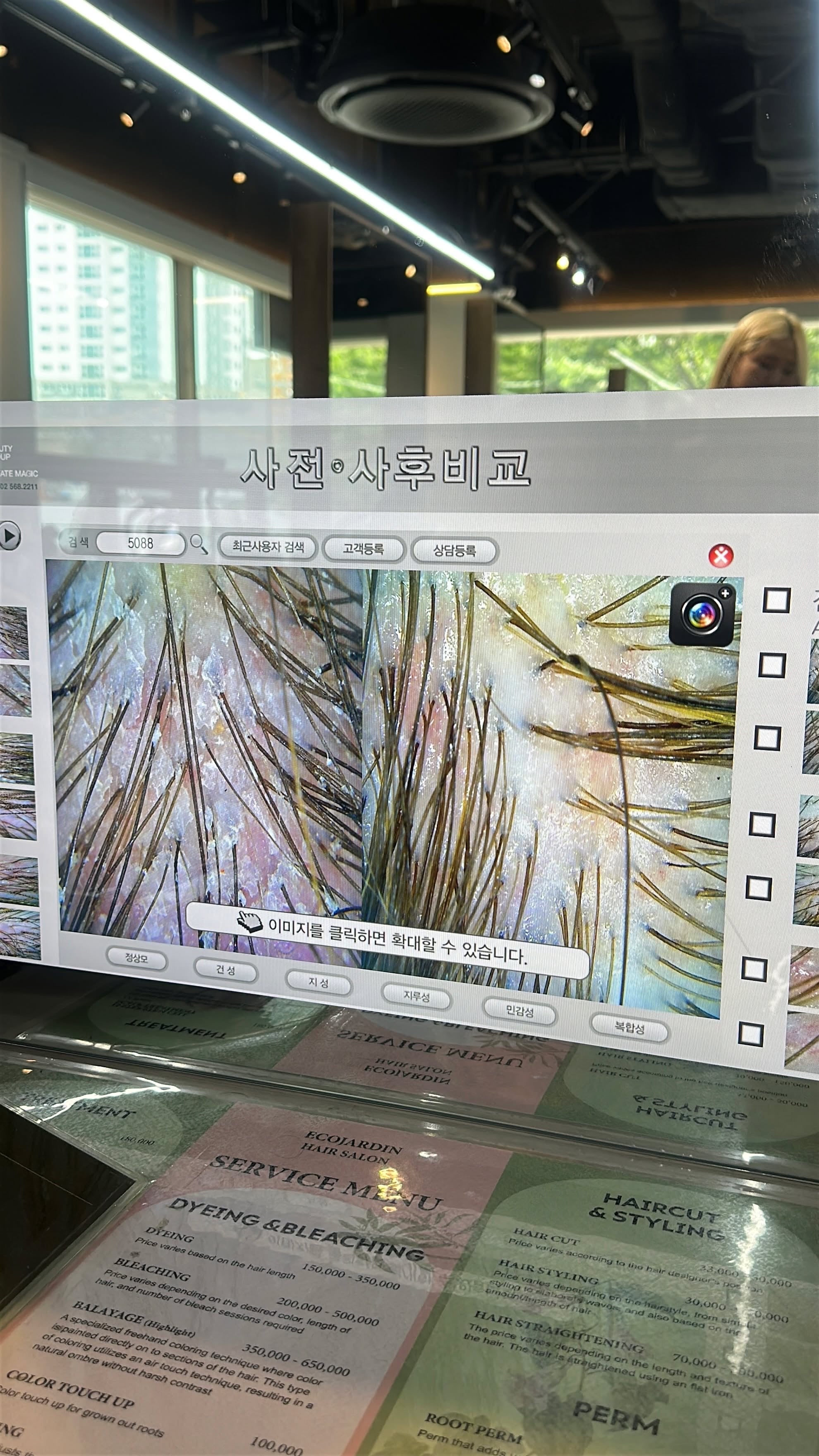 Hayley had her scalp health analysed on a trip to South Korea