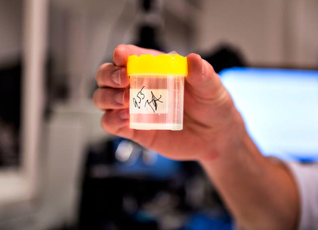 By the 1970s, Denmark had established a public sperm bank supplying clinics across Denmark, Norway and Iceland