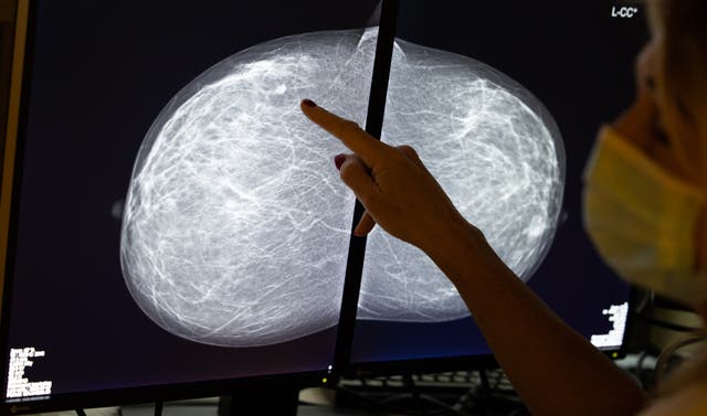 Sitting is tied to higher rates of obesity. That chronic condition is linked to rising rates of cancer including breast cancer - the most common type of the disease in women