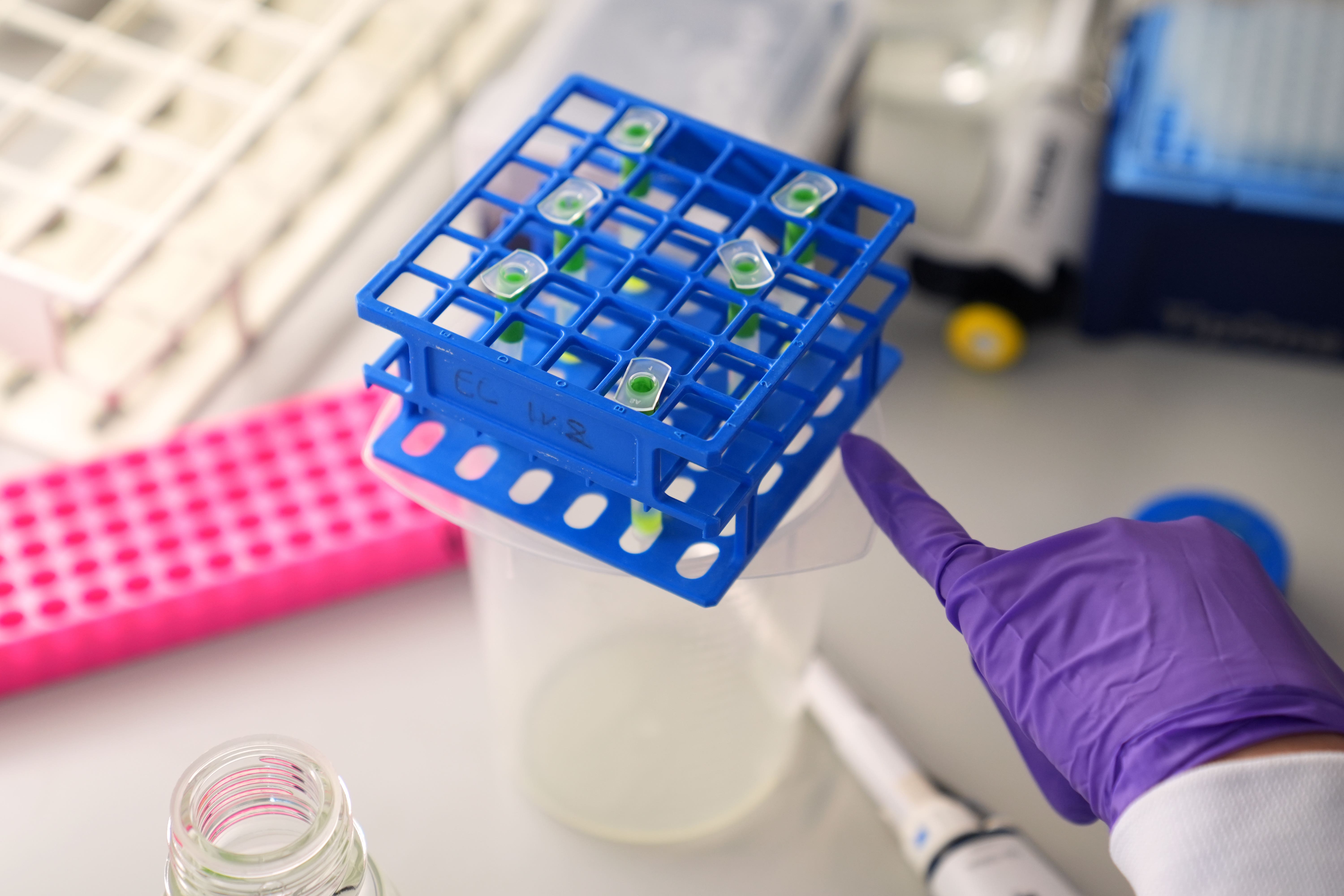 independent.co.uk - Nick Forbes - AI could 'supercharge' fight against cancer, researchers say