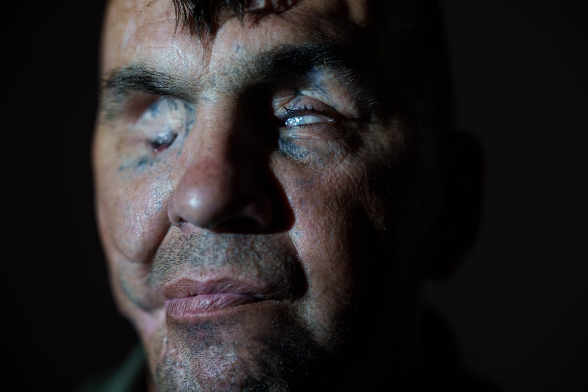 A Ukrainian soldier lost his sight in war. Now he hopes to see his children again