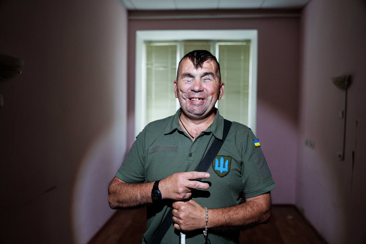 A Ukrainian soldier blinded in war hopes to see his children again, in photos