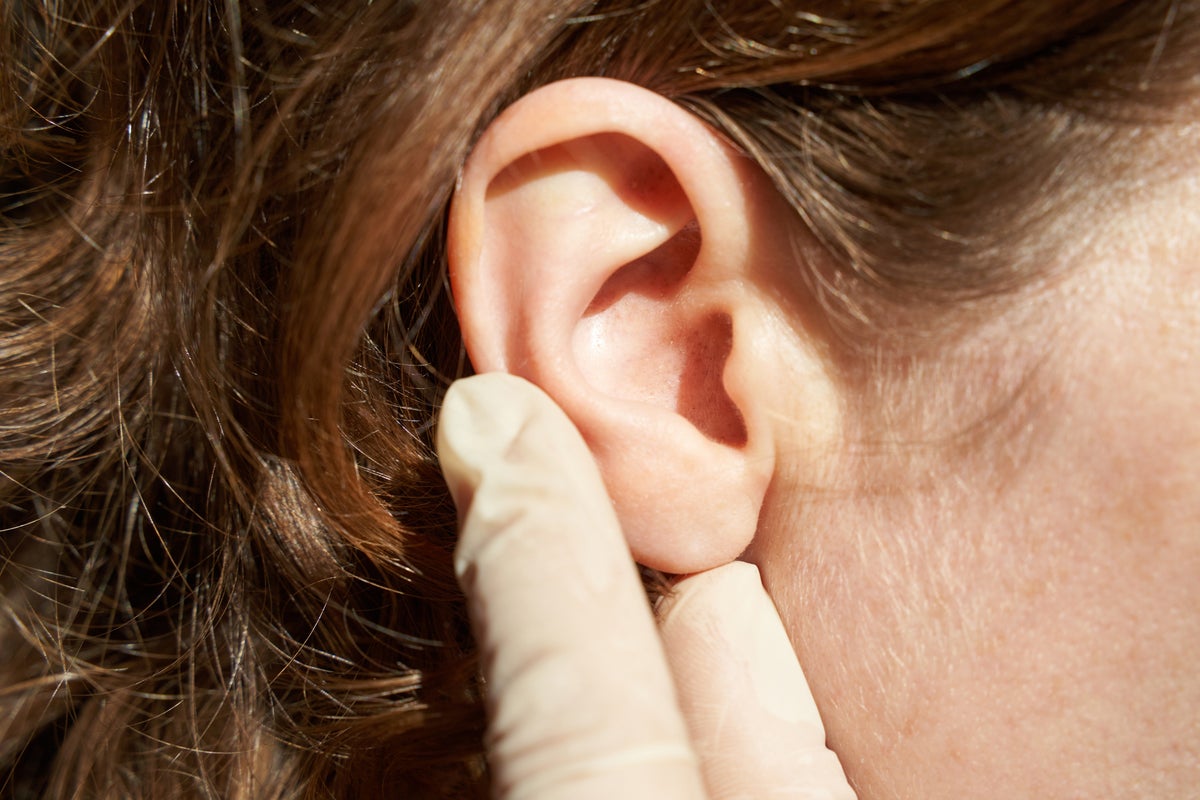 Scientists explore earwax’s slippery-sticky properties for potential insect repellents