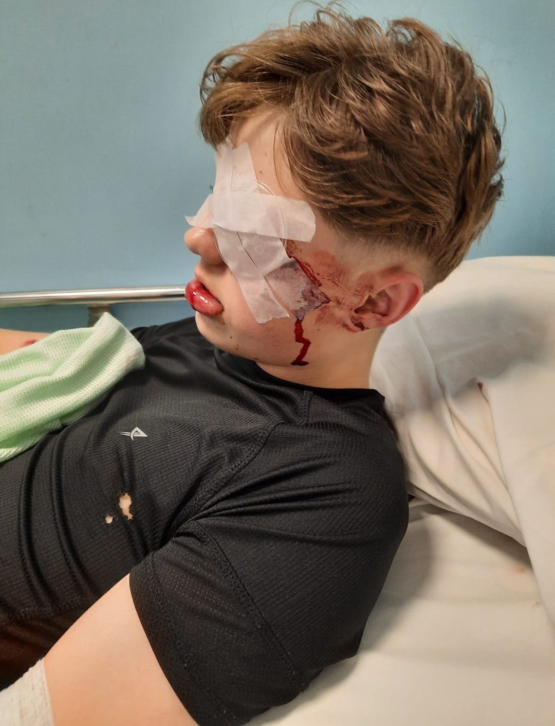 Bonfire Night “is a great opportunity to be with friends and family” but children can be the ones paying the price when things go wrong, the NHS said