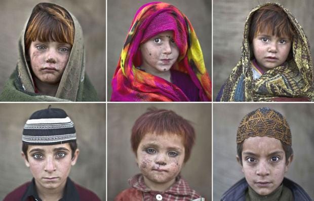 Afghan refugee children in a slum on the outskirts of ...