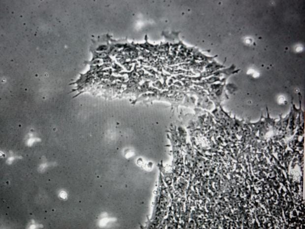 Stem-cells.jpg